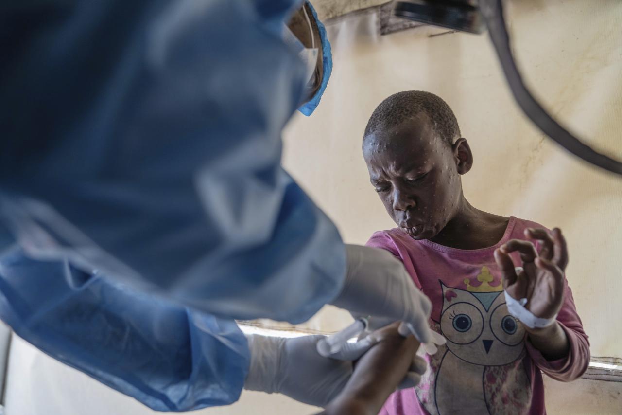 Congo reports more than 1,000 new mpox cases in a week. African authorities ask for vaccines