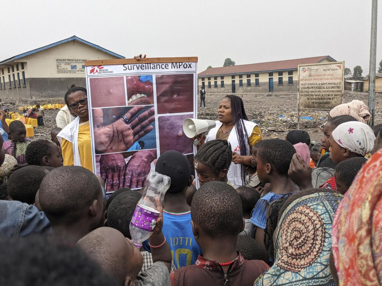 WHO declares mpox outbreaks in Africa a global health emergency as a new form of the virus spreads