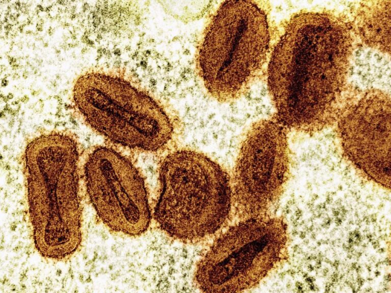 US health officials report 1st case of new form of mpox in a traveler