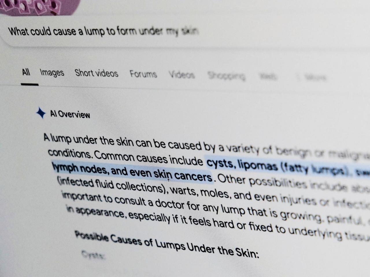 What’s that rash? Put some thought into asking Google for medical help